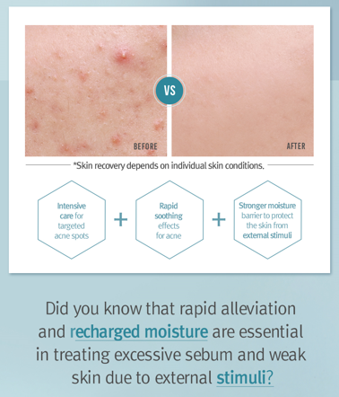 Pyunkang Yul ACNE Dressing Mask Pack