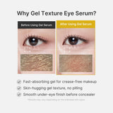 Medicube Kojic Acid Turmeric Eye Gel Serum 30ml