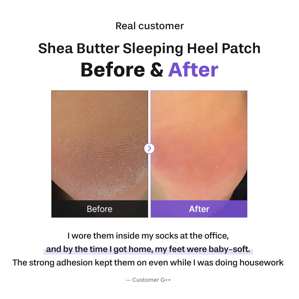 BAREN Shea Butter Sleeping Heel Patch 10ea