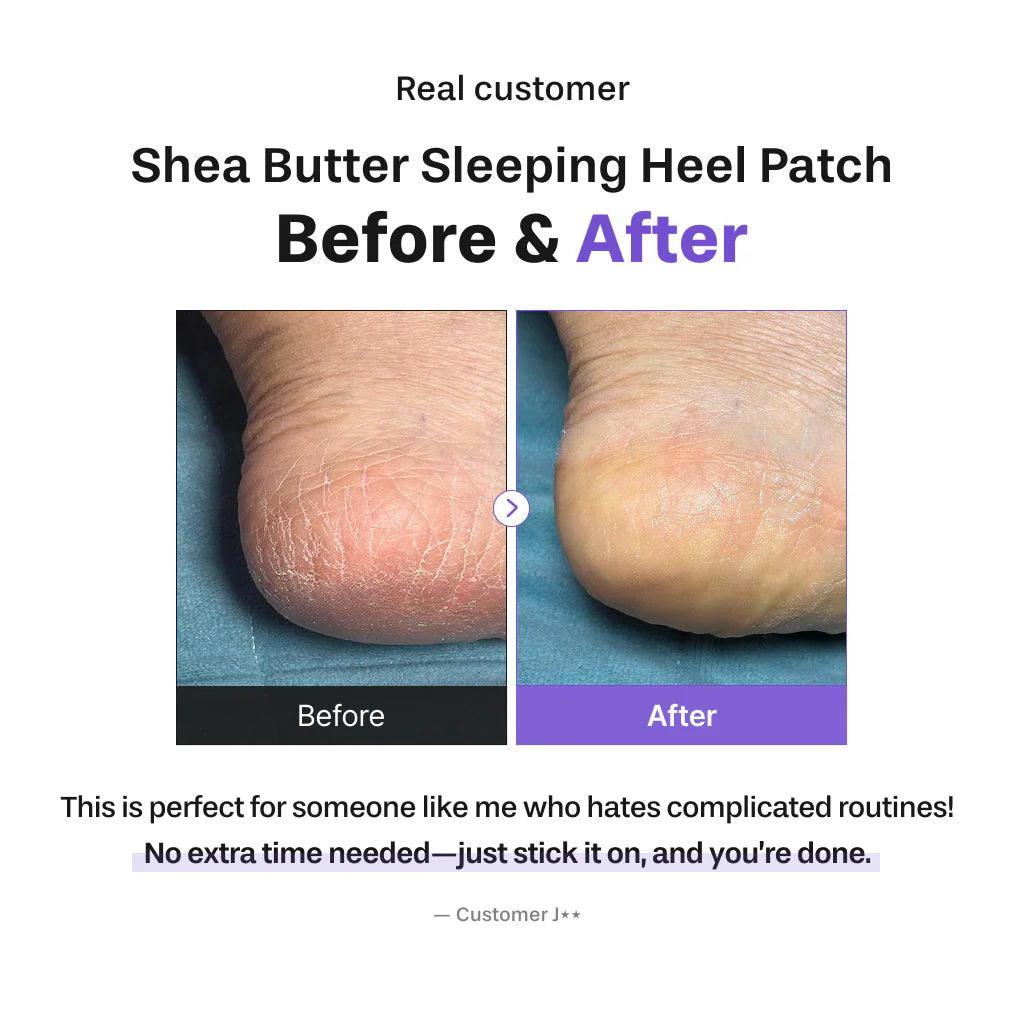 BAREN Shea Butter Sleeping Heel Patch 10ea