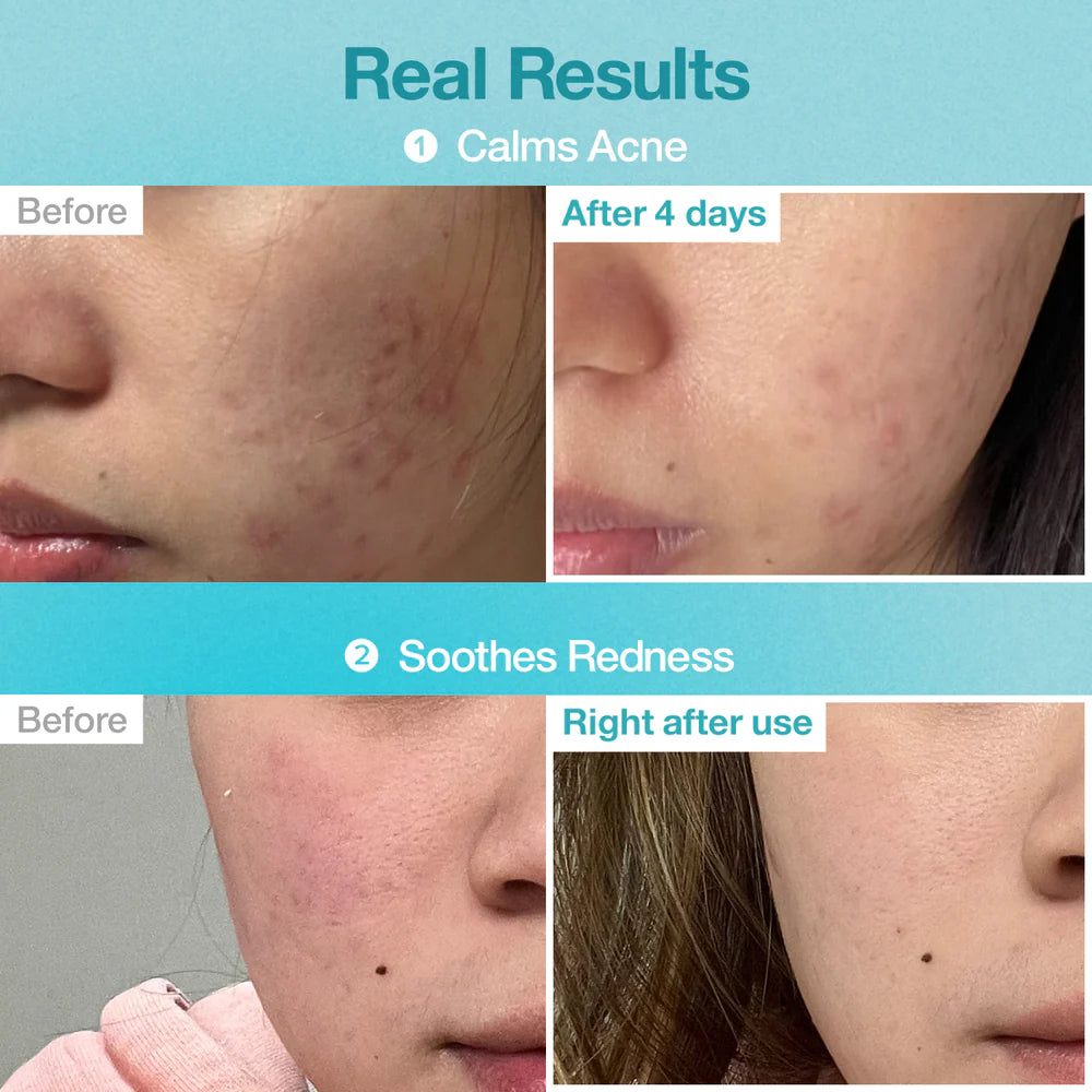 NUMBUZIN No.1 Pantothenic B5 Hyaluronic Active Clear Mask 26mL