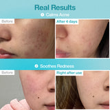 NUMBUZIN No.1 Pantothenic B5 Hyaluronic Active Clear Mask 26mL