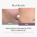 MEDICUBE Age-R Glutathione Glow Capsule Cream 50mL