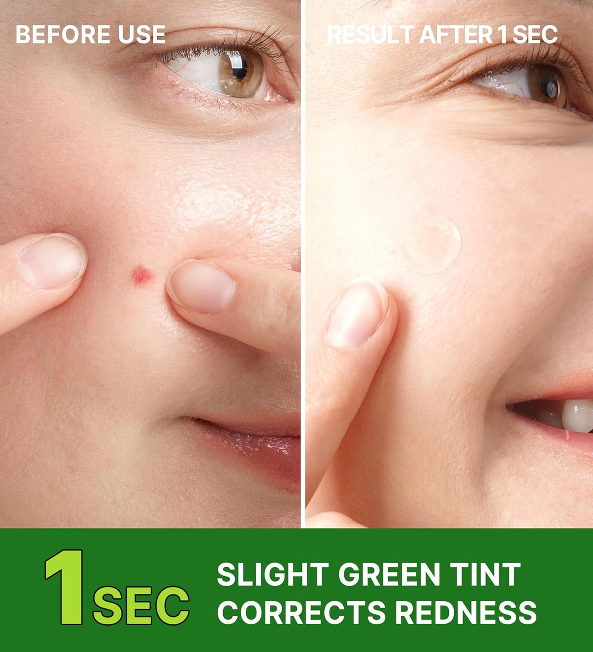 TROUBLESS Invisible Plus Spot Patch The Red Correct (96 Patch)
