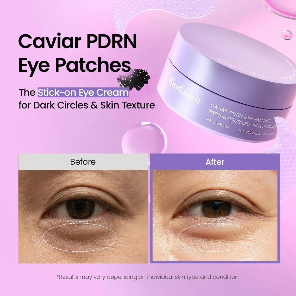 Biodance Caviar PDRN Eye Patches (30pcs)