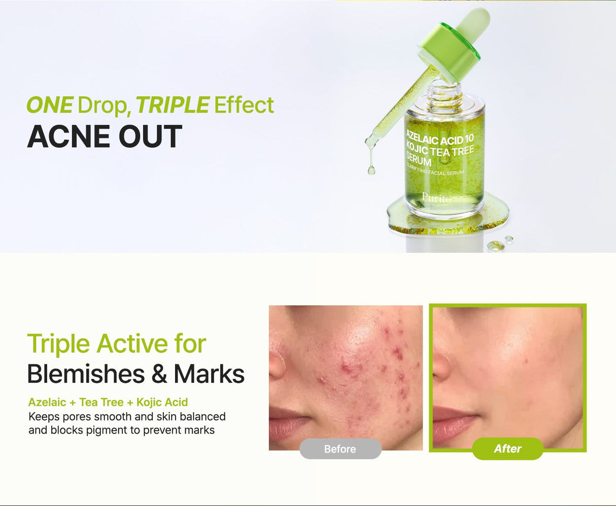 PURITO SEOUL Azelaic  10 Kojic Azulene Serum 30ml