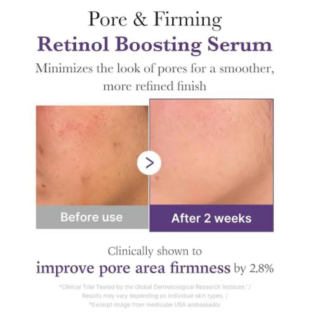 MEDICUBE Retinol NMN Boosting Serum 30mL