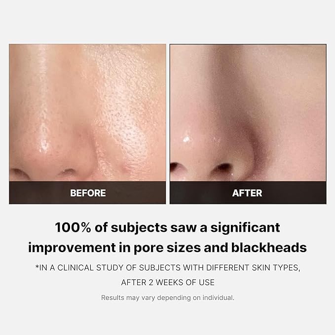 MEDICUBE Zero Pore Pad (70pcs)