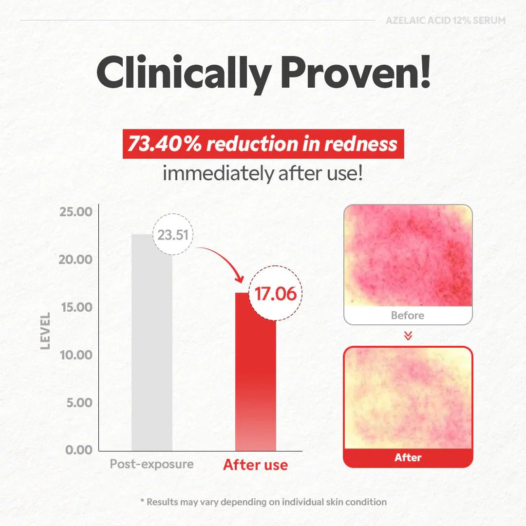 TIRTIR Azelaic Acid 12% Serum 30mL