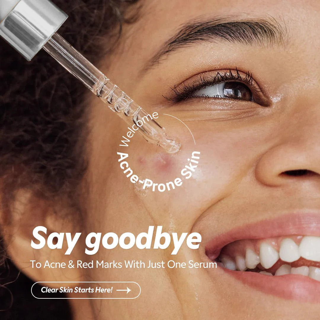 TIRTIR Azelaic Acid 12% Serum 30mL